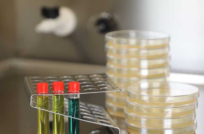 Foto of biological indicators